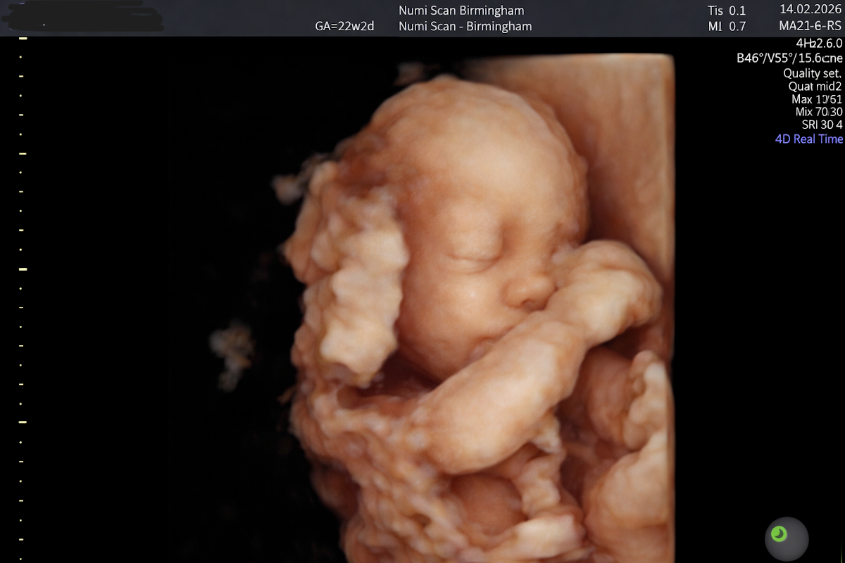 Numi Scan Birmingham — Dr.Visor photo 4