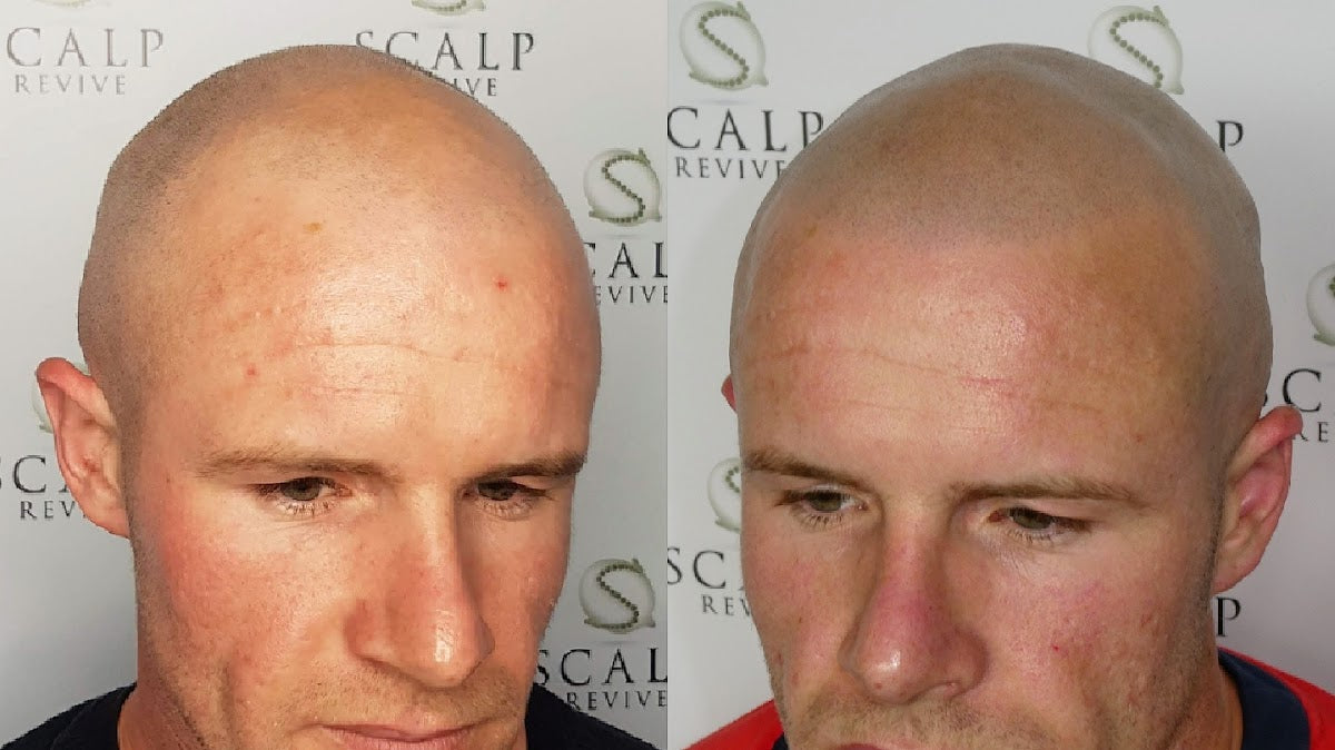 Scalp Revive — Dr.Visor