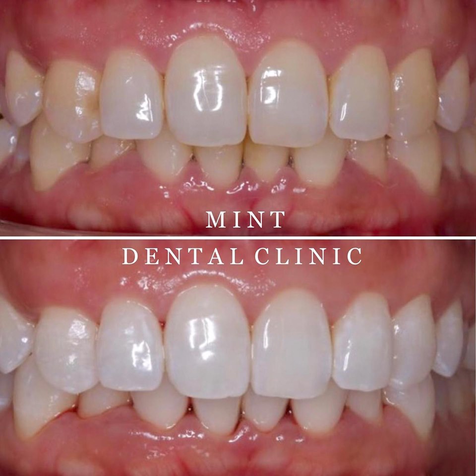 Mint Dental Clinic — Dr.Visor photo 2