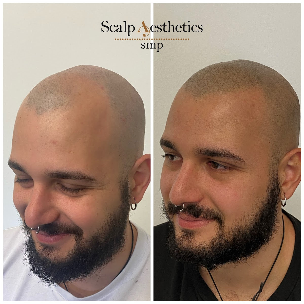 Scalp Aesthetics smp — Dr.Visor photo 4