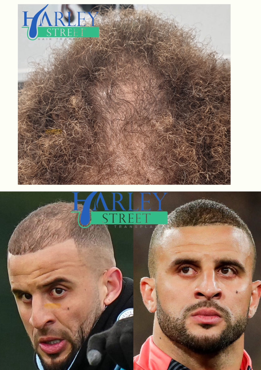 Edinburgh Hair Transplant Clinics — Dr.Visor photo 2