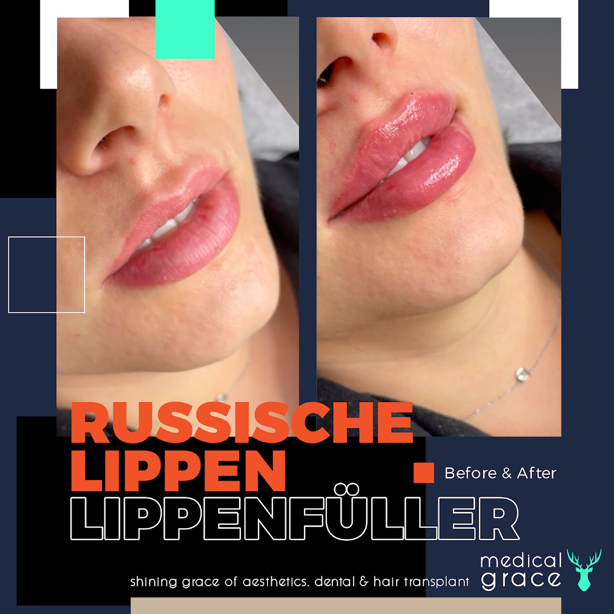 Medical Grace Bodrum Aesthetics — Dr.Visor photo 5