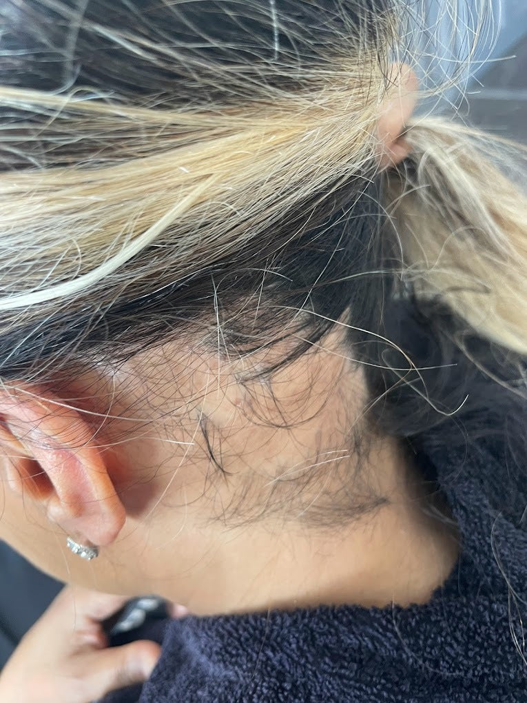 Hairlossandscalpclinic — Dr.Visor photo 2