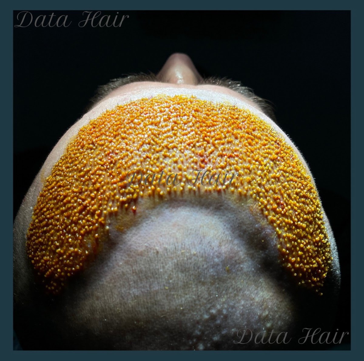 Data Hair Clinic & Eyyüp Tütüncü Saç Ekim Merkezi — Dr.Visor photo 4
