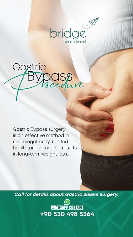 Gastric Sleeve Clinic Turkey — Dr.Visor photo 4