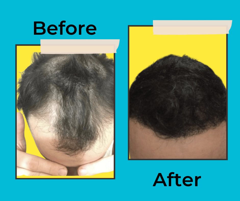 Harley Street Healthcare - Hair Transplant Clinics — Dr.Visor photo 3