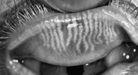 Dry Eyes Clinic Manchester — Dr.Visor photo 3