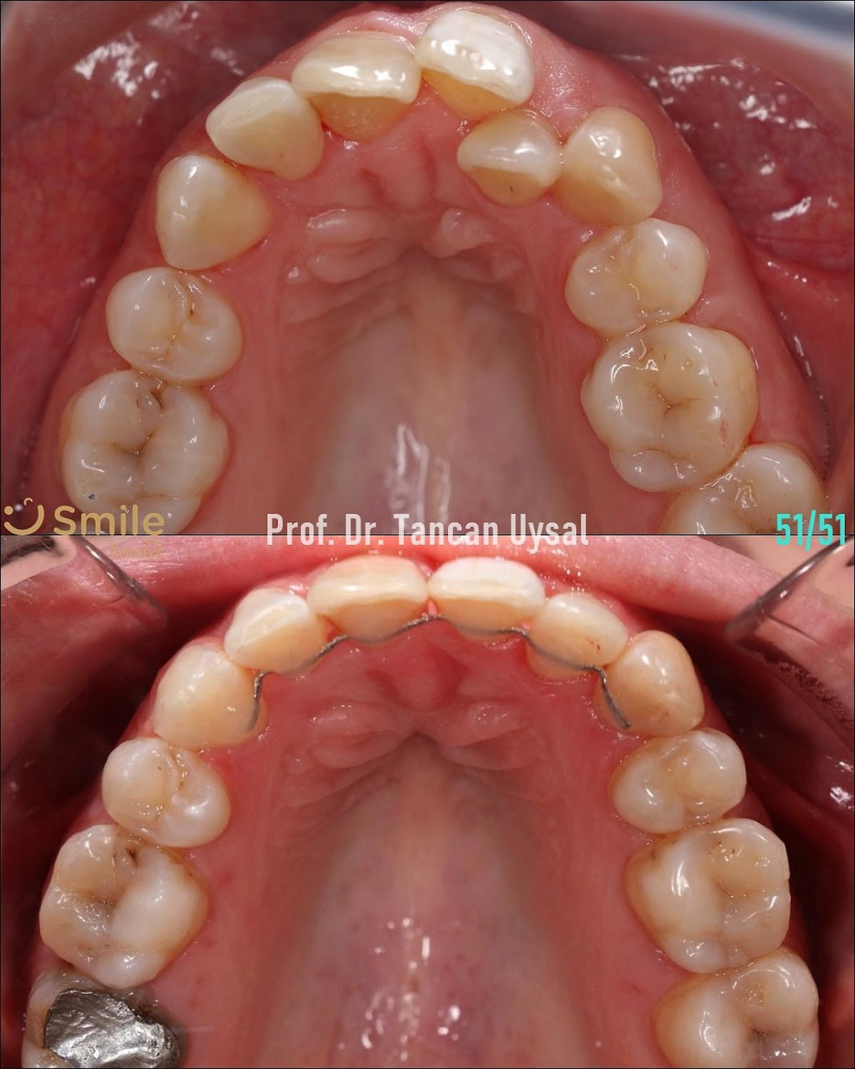 Smile İzmir — Dr.Visor photo 3