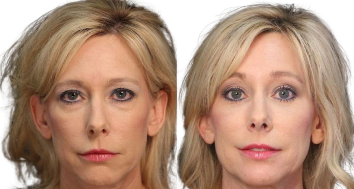 Vivid Clinic | Cosmetic Surgery Istanbul, Turkey — Dr.Visor photo 3