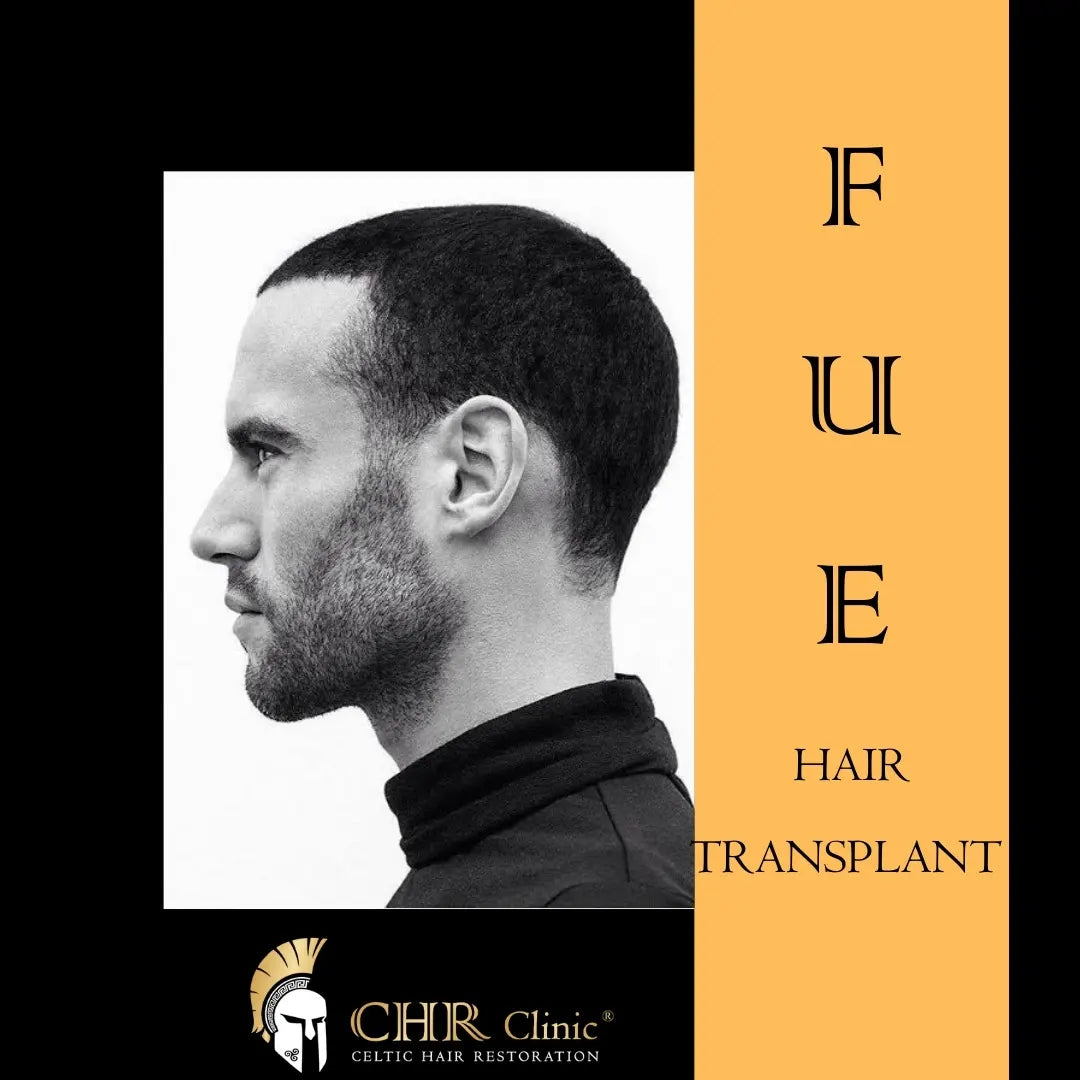 Celtic Hair Restoration Clinic — Dr.Visor photo 4