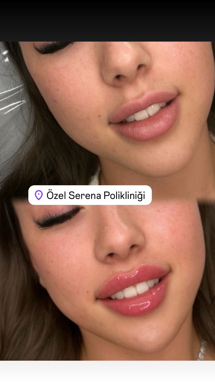 Op. Dr. Meltem Kılıç | İzmir Plastik, Rekonstrüktif ve Estetik Cerrahi | Aesthetics İzmir — Dr.Visor photo 5
