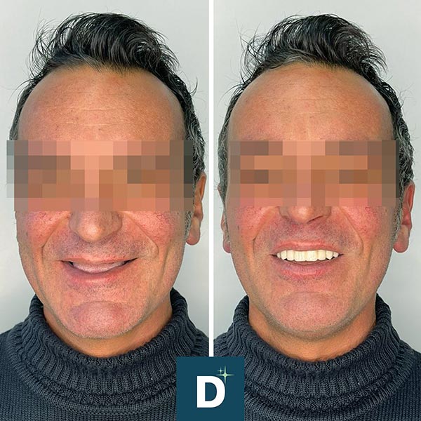 Denti a Vita Dental Clinic, Tirana, Albania