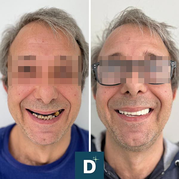 Denti a Vita Dental Clinic, Tirana, Albania
