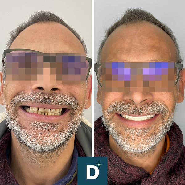 Denti a Vita Dental Clinic, Tirana, Albania