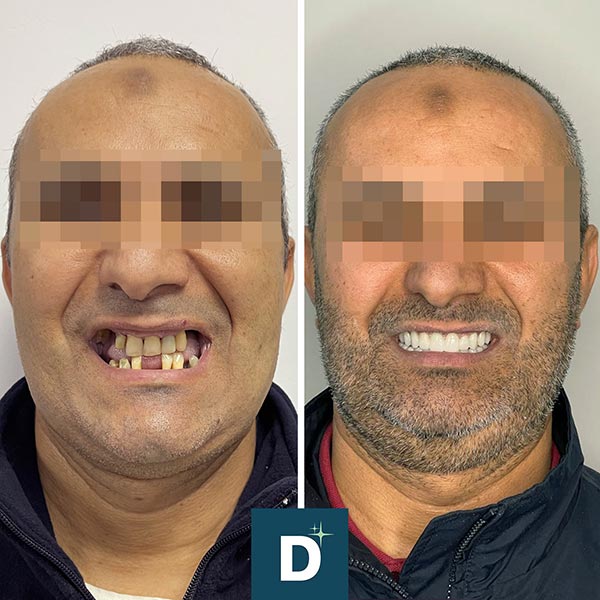 Denti a Vita Dental Clinic, Tirana, Albania