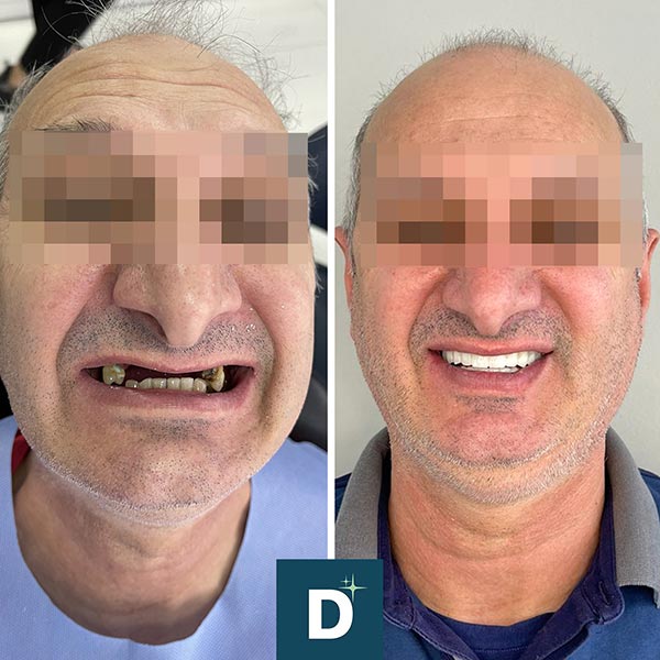 Denti a Vita Dental Clinic, Tirana, Albania