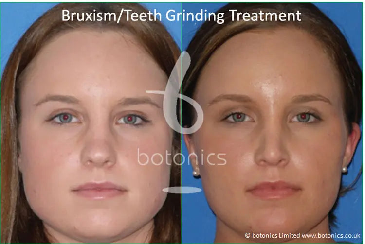 Botonics - Harley Street, Aesthetic Clinic