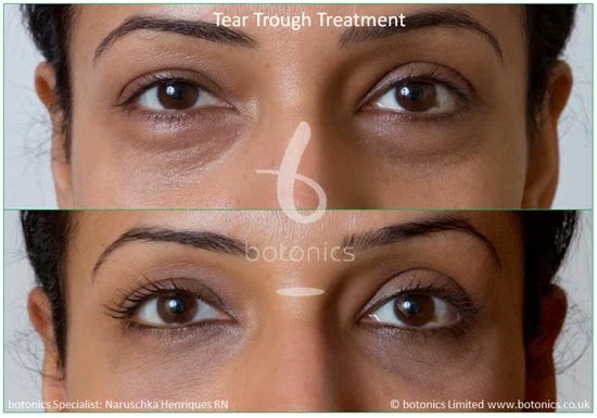 Botonics - Harley Street, Aesthetic Clinic